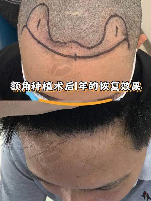 韩国来丽Larre整形外科医院怎么样?