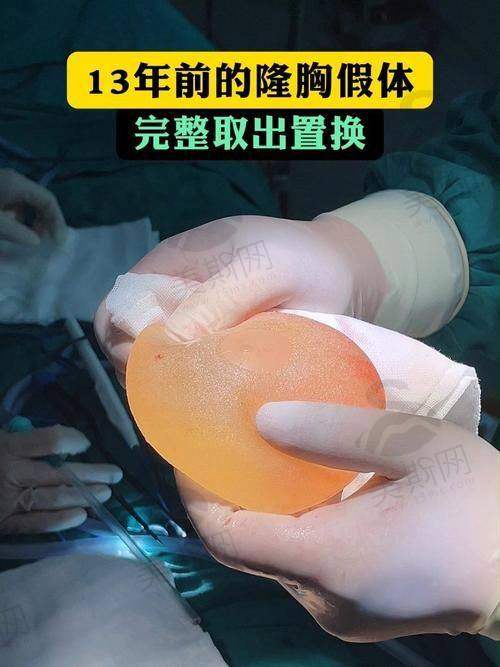 韩国欧佩拉opera整形医院预约挂号