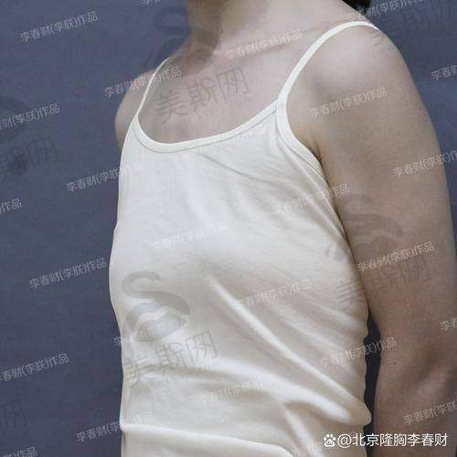 韩国珠儿丽Jewelry整形医院诊疗项目