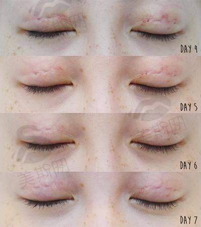 韩国赫拉(HERA)整形医院诊疗项目