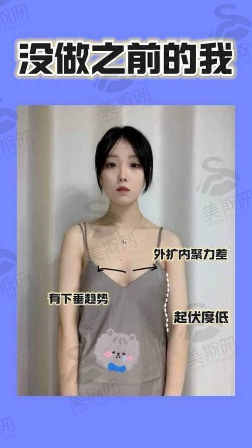 韩国必当归整形医院怎么样?