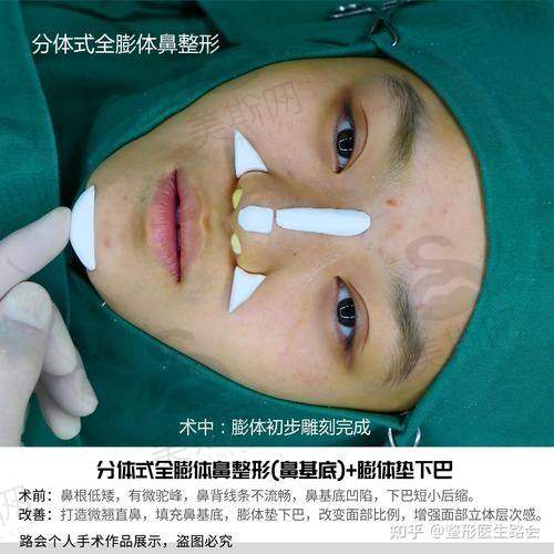 韩国赫拉(HERA)整形医院预约挂号