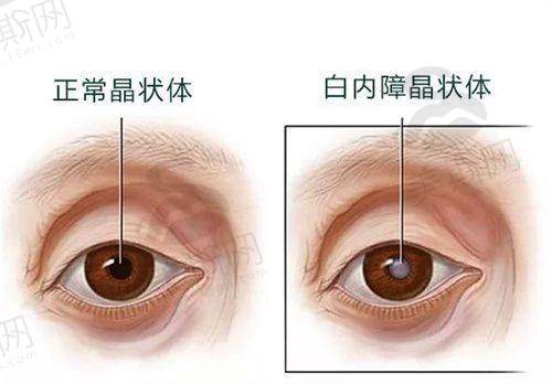 深圳大学总医院眼科医院特色技术