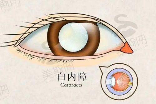 2. 个性化手术方案设计