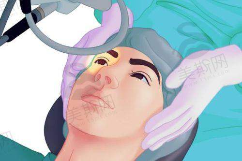 二、重庆佰视佳眼科赵小虎医生从业多年飞秒手术骨干医生的实战担当