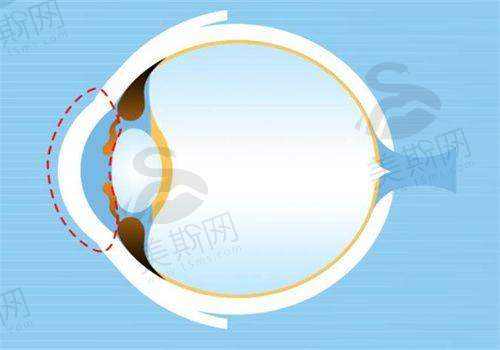 六、重庆伯视佳眼视光医苑就诊指南