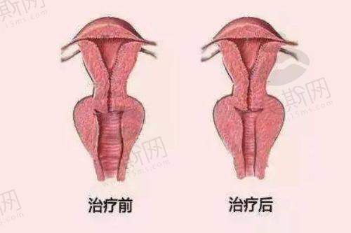 广州韩妃整形医生排名情况