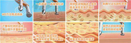广州韩妃整形美容医院刘志刚院长做假体隆胸，揭秘韩妃刘志刚医生及广州韩妃整形医生排名情况