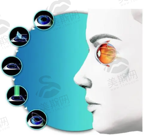 三、重庆佰视佳眼科飞秒技术优势解析技术、设备与服务的三重保护