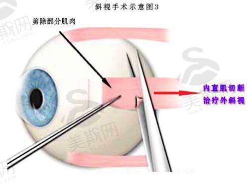 广州市第一人民医院眼科诊疗项目