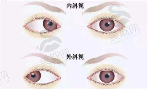 北京同仁医院眼科预约挂号