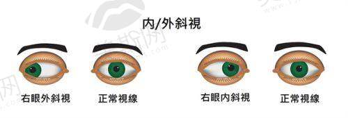 广东省第二人民医院眼科是国有的吗？