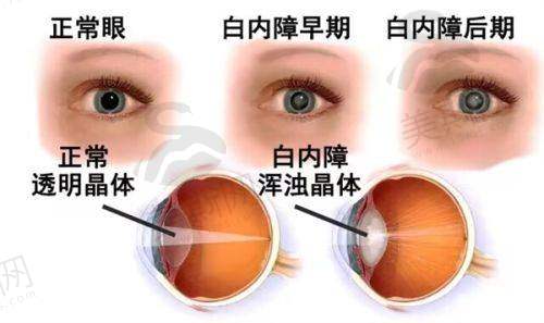 康平县人民医院眼科医院预约挂号