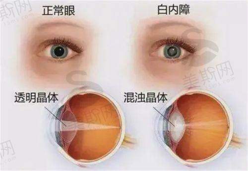 沈北新区中 心医院眼科特色技术