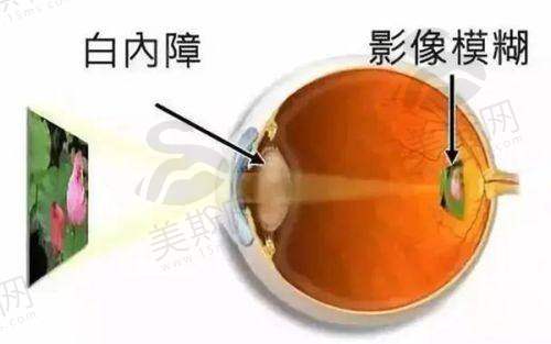 深圳市第二人民医院眼科预约挂号