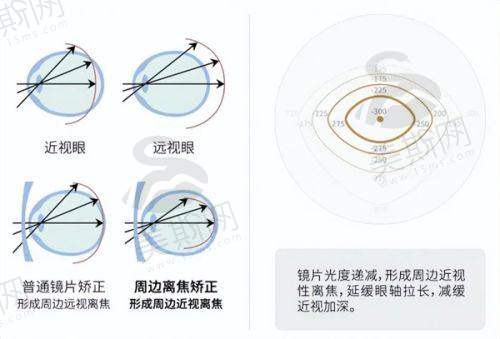 昆明康特森眼科医院口碑情况
