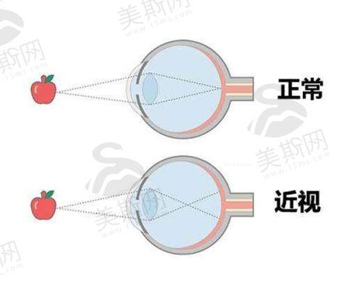 六、上海和平眼科医院便捷预约通道全指南
