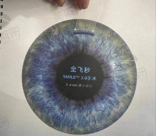 郑惠医生擅长项目