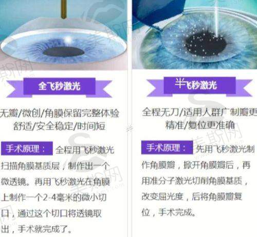 【患者实例2：儿童近视防控】