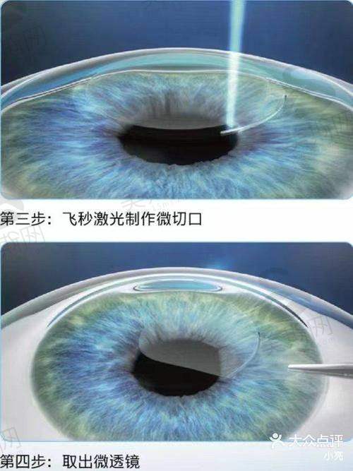 王立东医生口碑评价及真实实例