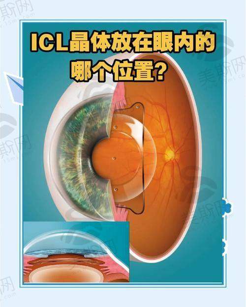 深圳市第二人民医院眼科正规吗?