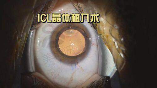 河南省人民医院眼科正规吗？