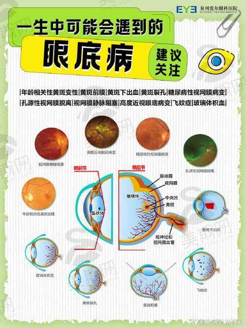 深圳市第三人民医院眼科特色技术