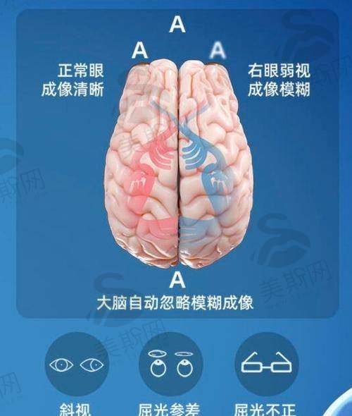 重庆大坪医院眼科诊疗项目