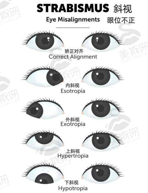 广州市第一人民医院眼科是国有的吗?