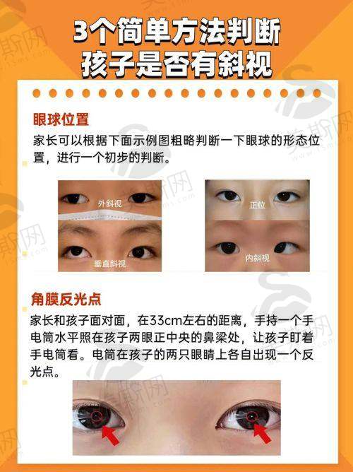 广州医 科 大学附属第二医院眼科医院正规吗?