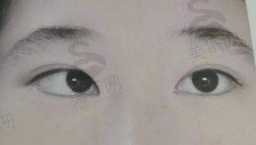 沈阳市第五人民医院眼科正规吗？