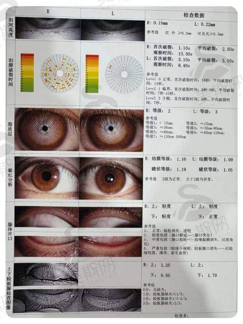 香港大学深圳医院眼科特色技术