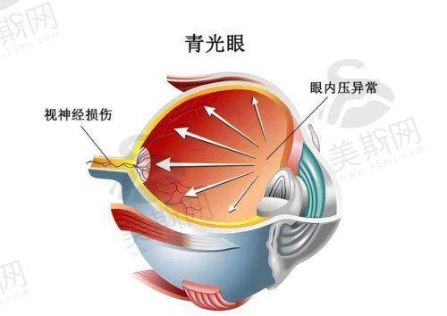广州医 科 大学附属第二医院眼科医院是国有的吗?