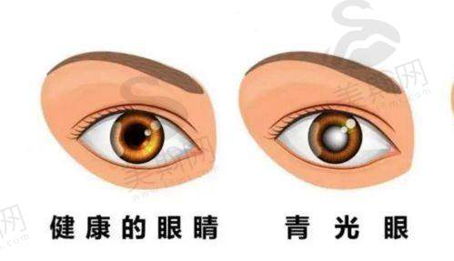 广州市第一人民医院眼科怎么样?