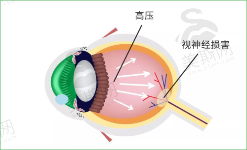 深圳市人民医院眼科地址电话