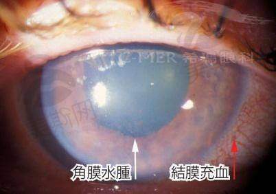 中山大学附属第八医院眼科正规吗?