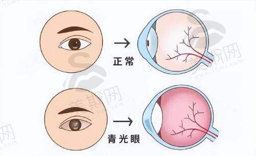 长春一诺眼科医院诊疗项目