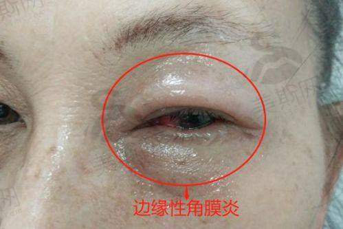 遵义医 科 大学附属医院眼科是国有的吗?