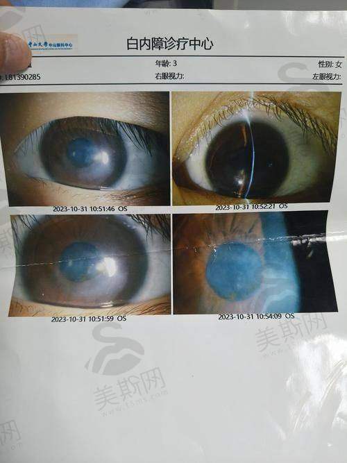 苏家屯区中 心医院眼科怎么样？
