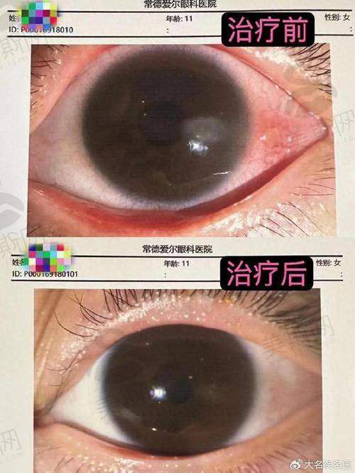 广东省第二人民医院眼科诊疗项目