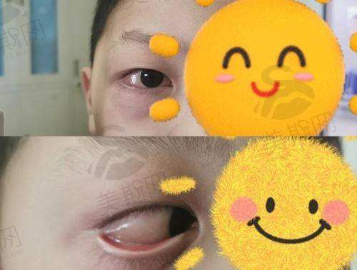 广州医 科 大学附属第一医院眼科特色技术