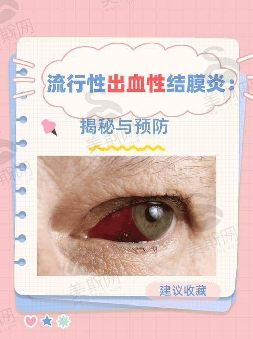 康平县人民医院眼科医院特色技术