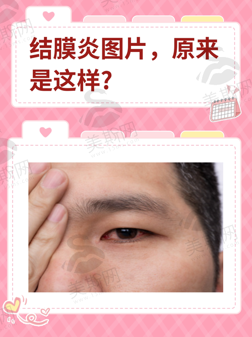 辽宁中 医 药大学附属医院眼科正规吗？