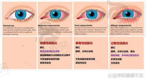 深圳市妇幼保健院眼科诊疗项目