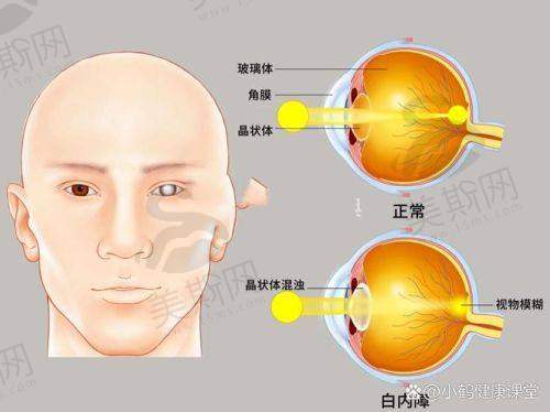 深圳市儿童医院眼科特色技术