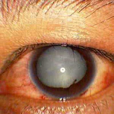 6、西安四院眼科团队介绍