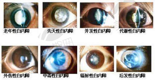 沈北新区中 心医院眼科价格表