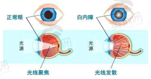 王立东医生坐诊医院：广州视百年眼科医院