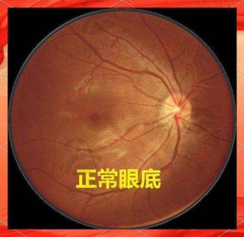 华中科技大学协和深圳医院眼科价格表