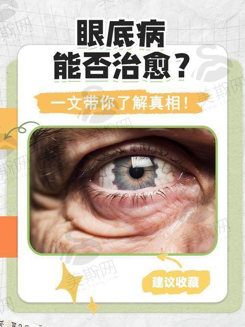 南方医 科 大学深圳医院眼科怎么样?